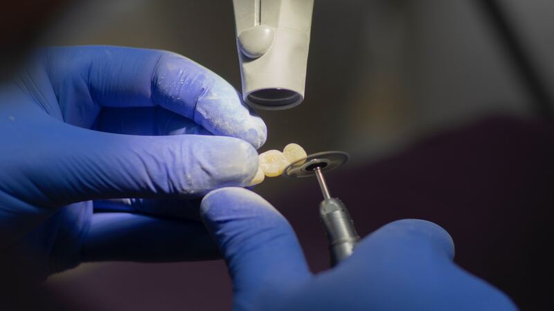 Implant Dentistry in Stoke-on-Trent