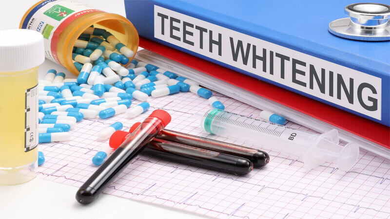 Teeth Whitening FAQs