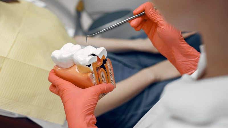 Understanding the causes and treatment options for dry socket after tooth extraction