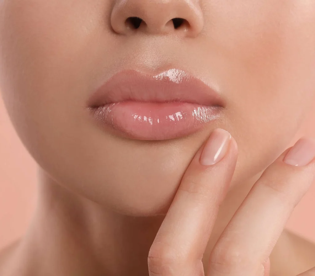lip fillers