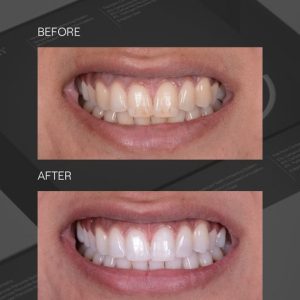 VfPPR8UQ-300x300